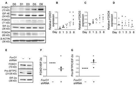 FOXO1 Couples KGF and PI-3K/AKT Signaling to NKX2.1-Regulated ...