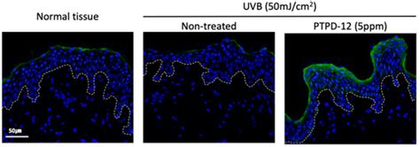 Skin Barrier-Improving and Skin-Soothing Effects of Autophagy ...