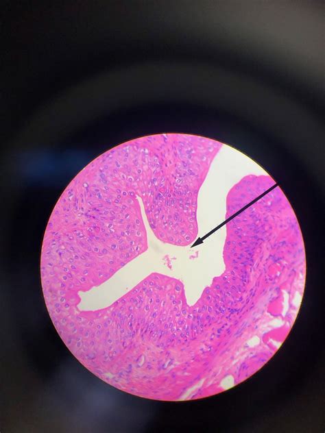 Histology - Transitional Epithelial Diagram | Quizlet