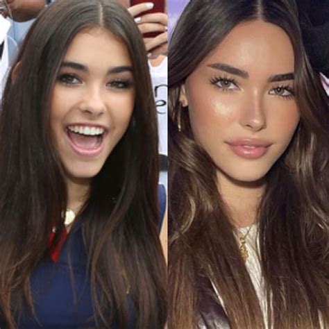 Madison Beer plastic surgery | Plastic surgery, Madison beer plastic surgery, Madison beer outfits