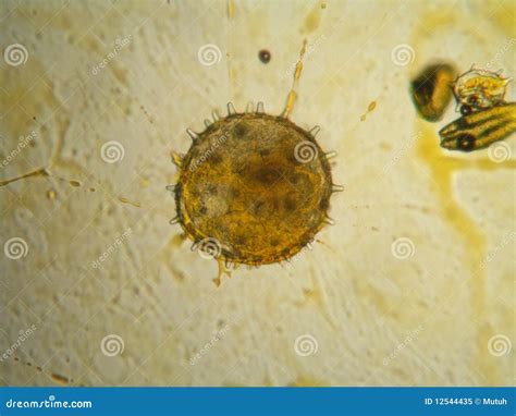 Pollen under a microscope stock image. Image of magnification - 12544435