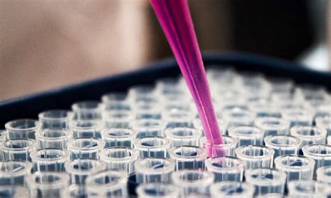 Antimicrobial resistance on the rise due to Inappropriate use of ...