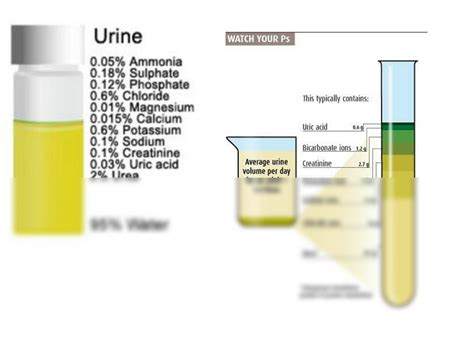 SOLUTION: Complete urinalysis - Studypool