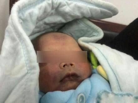 四川男婴出生2天被遗弃 父母称想要个女儿(图)_央广网
