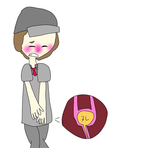 Image result for Exploding Bladder