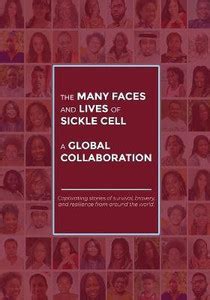 The Many Faces and Lives of Sickle Cell - A Global Collaboration: Buy ...