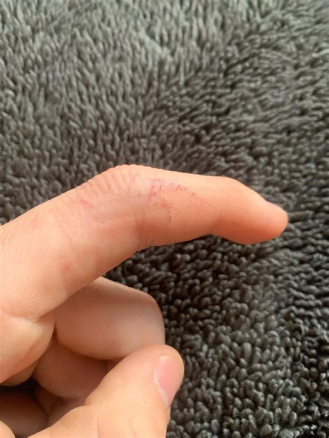 Image result for Ball Python Biting Human