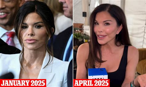 Lauren Sanchez sparks speculation she's had 'more' plastic surgery