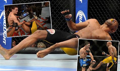 Anderson Silva Broken Leg Video