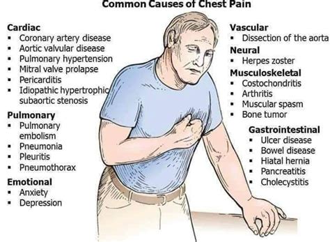 Common cause of chest pain - MEDizzy