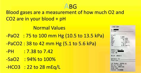 Oxygen therapy in pediatrics | PPTX