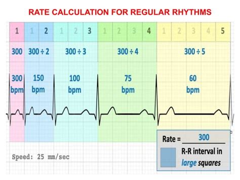 Steps for Using an ECG Machine 的图像结果