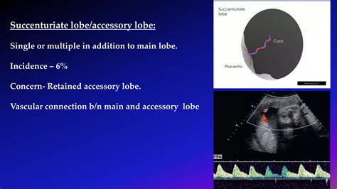 Ultrasound Imaging of Placenta | PPTX