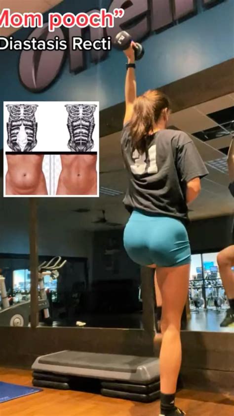 10 crucial steps to get rid of your c section shelf – Artofit