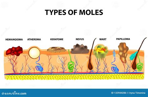 How Do Skin Moles Form