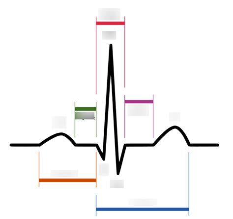 Basic EKG Class 的图像结果