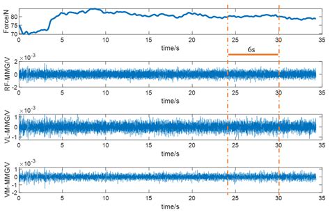 Estimation of Knee Joint Extension Force Using Mechanomyography Based ...
