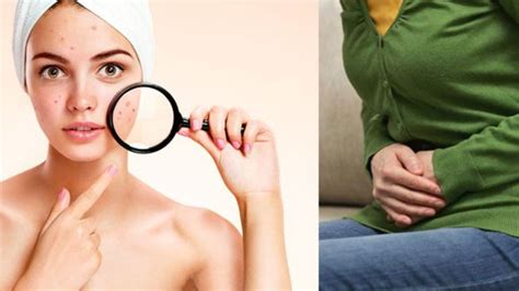 What is PCOS? The hidden struggle of one in five young Indian women ...