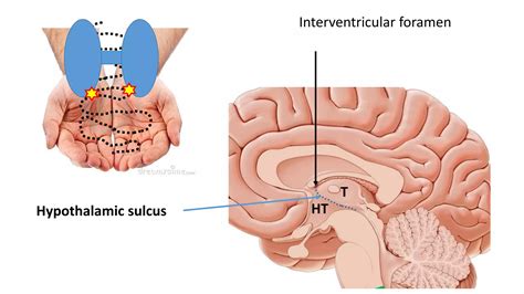 Antomy of Thalamus and hypothalamus | PDF