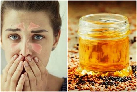Home remedies for choke nose instant relief Health News in hindi-रह ...