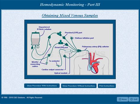 SvO2 的图像结果