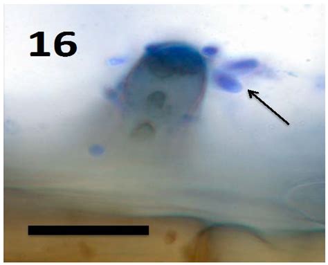 Rhizophagy Cycle: An Oxidative Process in Plants for Nutrient ...