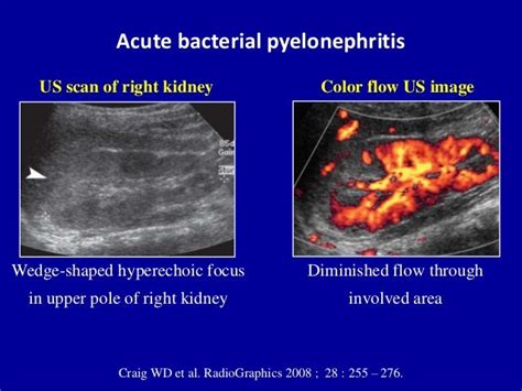 Image result for Alien Ware Semi