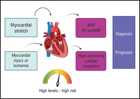 The Role of Biomarkers in Heart Failure with Preserved Ejection Fraction - ABC Heart Failure ...
