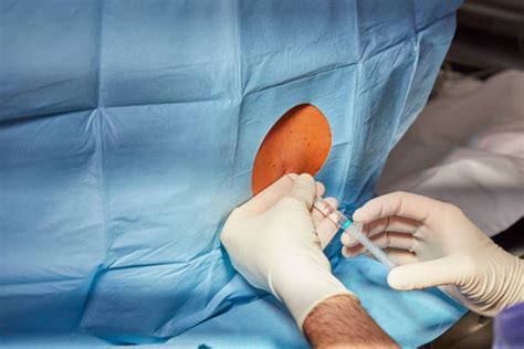 Injection Back Side 的图像结果