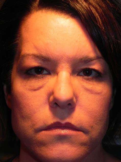 The Deeper Meaning Behind "Bitchy Resting Face" - Adam Scheiner MD | Dr ...