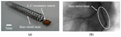 A Wireless Pressure Sensor Integrated with a Biodegradable Polymer ...