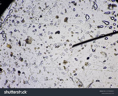 Pinworm Eggs On Tape