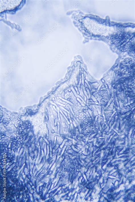 Mold Under Microscope 的图像结果