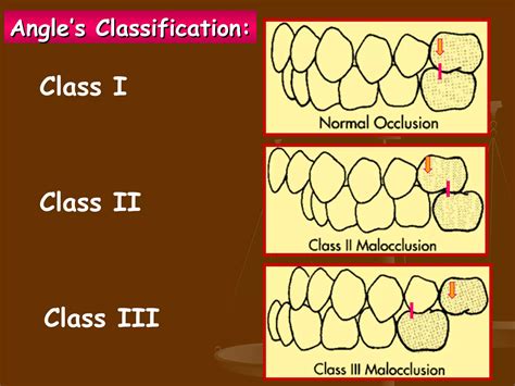 Dental Occlusion | PPT | Dental Health | Diseases and Conditions