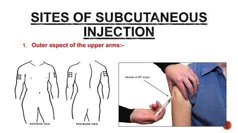 PPT-Administration-of-Subcutaneous-Injection-.pptx.ppt