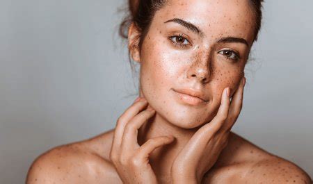 Dark spots on the skin | BIODERMA