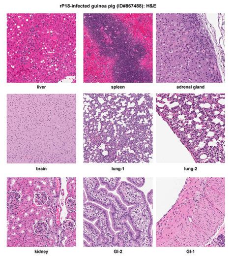 Pichinde Virus Infection of Outbred Hartley Guinea Pigs as a Surrogate ...