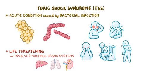 How Rare Is Toxic Shock Syndrome