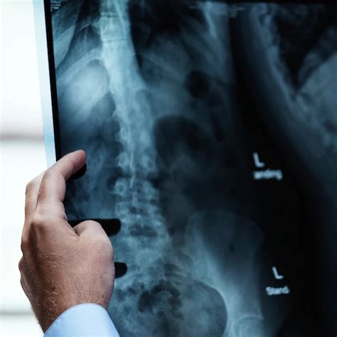 X-Ray: Imaging Tests For Clinical Diagnosis