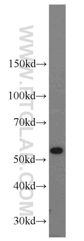 CBS antibody (14787-1-AP) | Proteintech