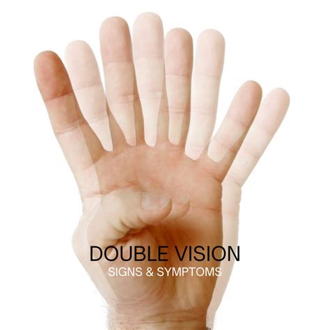 Understanding Double Vision: Causes, Symptoms, and Treatments