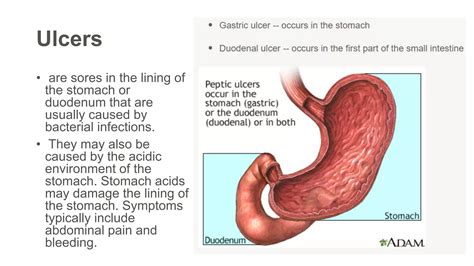 Digestive System Diseases 的图像结果
