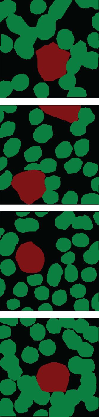 Image result for Normal Blood Segmenter Values