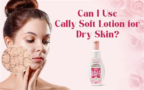 Can You Use Cally Soft Lotion for Dry Skin? Benefits & Safety – Healing ...
