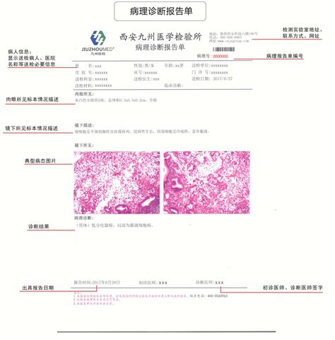 病理报告单图片模板大全 - 我要证明网