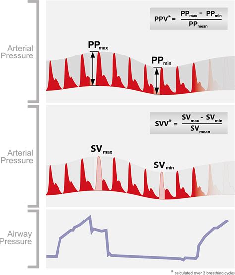 Image result for Pulse Pressure Variation Explained