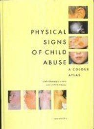 Buy Atlas of Child Abuse: A Colour Atlas Book Online at Low Prices in ...