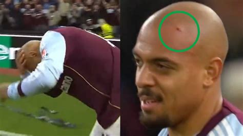 Scary Scenes! Donyell Malen Suffers Nasty Head Injury As He Gets Struck ...