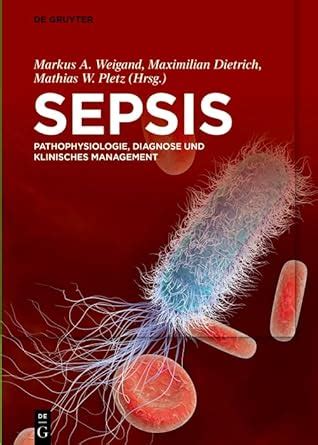 Sepsis: Pathophysiologie, Diagnose und klinisches Management (German ...