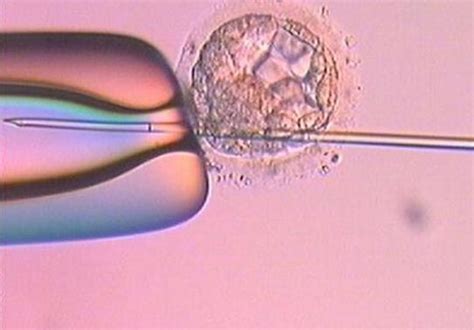 美国试管婴儿中选择单胎还是多胎移植？_美中桥